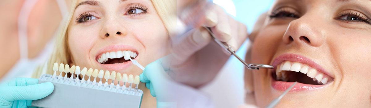 Dental Treatments for Every Need