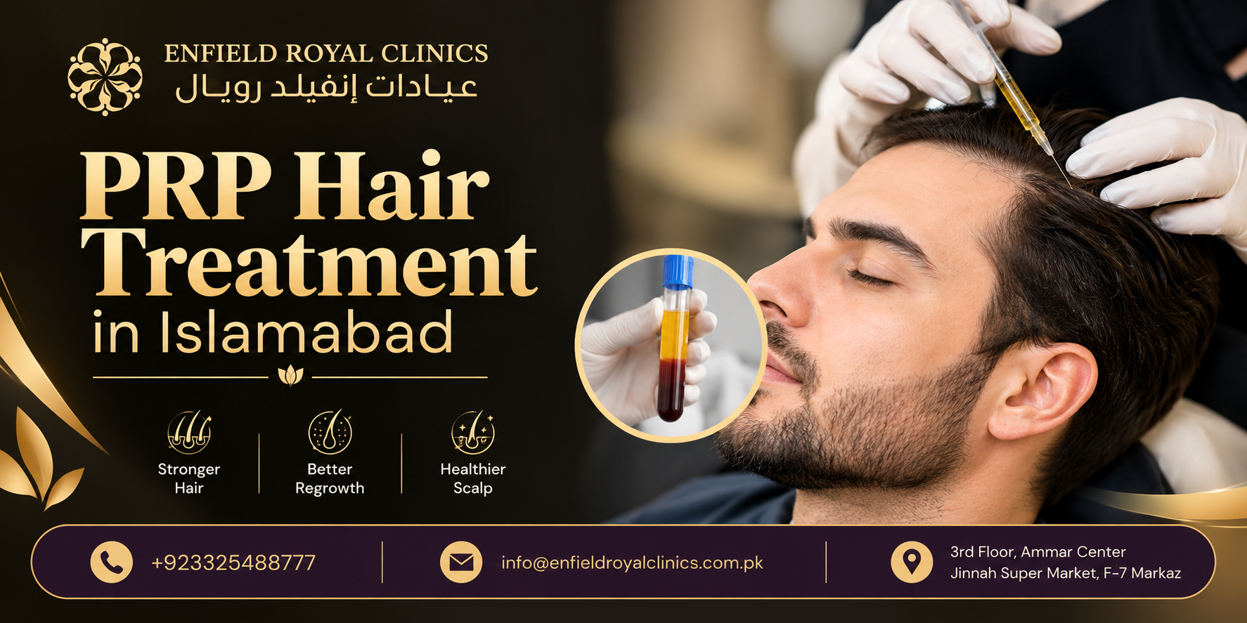PRP Hair Treatment in Islamabad (2)