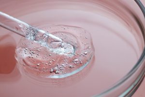 glycolic-acid-for-skin