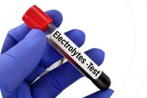 electrolytes test in Lahore
