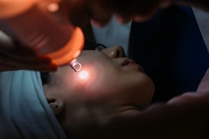 Skin Laser Treatment in Johar Town, Lahore